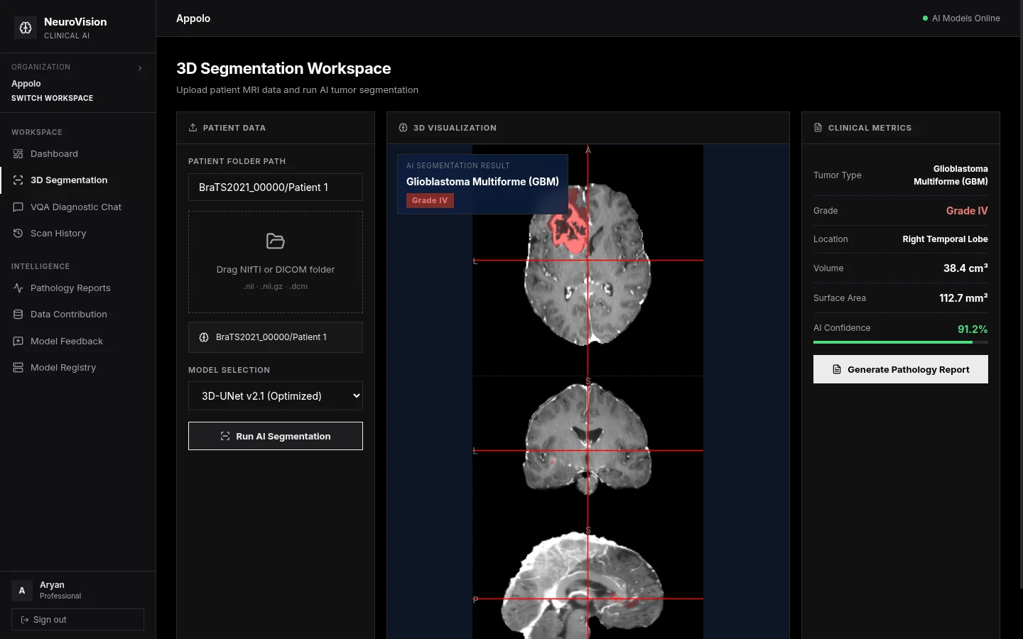 3D Brain Visualization with Segmentation Overlay